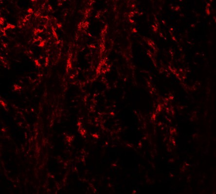 Immunofluorescence of NINJ1 in mouse brain tissue with NINJ1 antibody at 20 ug/ml.
