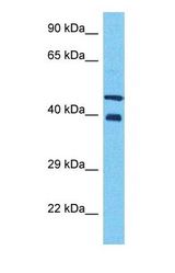 Western blot of NF2IP Antibody with human 721_B Whole Cell lysate.