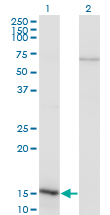 Western blot of NFATC2IP expression in transfected 293T cell line by NFATC2IP monoclonal antibody (M02), clone 3E9-B7.