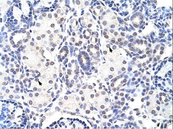 NIP7 antibody LS-C30585 was used in IHC to stain formalin-fixed, paraffin-embedded human kidney.