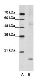 B: HepG2 Cell Lysate