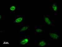 Immunostaining analysis in HeLa cells. HeLa cells were fixed with 4% paraformaldehyde and permeabilized with 0.1% Triton X-100 in PBS. The cells were immunostained with anti-NIP7 mAb.