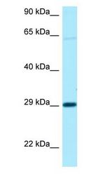 NIPA1 antibody Western Blot of 721_B.