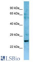 NIPAL3 / NPAL3 antibody Western Blot of Fetal Thymus. Antibody dilution: 1 ug/ml.