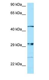 NIPAL3 / NPAL3 antibody Western Blot of ACHN.