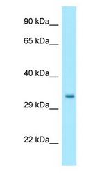 NIPSNAP1 antibody Western Blot of Fetal Liver.
