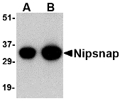 Western blot of NIPSNAP in human brain tissue lysate with NIPSNAP antibody at (A) 0.5 and (B) 1 ug/ml.