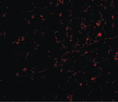 Immunofluorescence of nipsnap in human brain tissue with nipsnap antibody at 20 ug/ml.