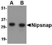 Western blot of NIPSNAP in human brain tissue lysate with NIPSNAP antibody at (A) 0.5 and (B) 1 ug/ml.