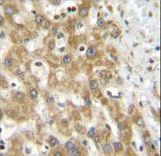 NPS3A Antibody immunohistochemistry of formalin-fixed and paraffin-embedded human liver tissue followed by peroxidase-conjugated secondary antibody and DAB staining.
