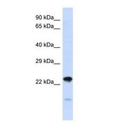 Western blot of Human HepG2. NIPSNAP3A antibody dilution 1.0 ug/ml.