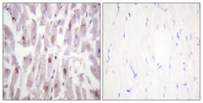 IHC of paraffin-embedded human heart, using PPAR-BP (Phospho-Thr1457) Antibody. The sample on the right was incubated with synthetic peptide.