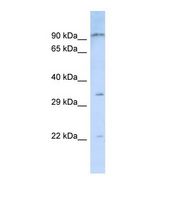 Western blot of Human Jurkat. NIPSNAP3B antibody dilution 1.0 ug/ml.