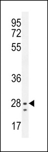 NIPSNAP3B Antibody western blot of mouse liver tissue lysates (35 ug/lane). The NIPSNAP3B antibody detected the NIPSNAP3B protein (arrow).