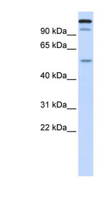 UHRF2 antibody LS-C109942 Western blot of Fetal liver lysate.