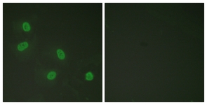 Immunofluorescence of HeLa cells, using PPAR-BP (Phospho-Thr1457) Antibody. The sample on the right was incubated with synthetic peptide.