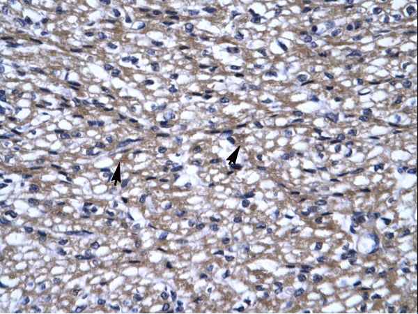 UHRF2 antibody LS-C29893 was used in IHC to stain formalin-fixed, paraffin-embedded human heart.