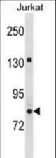 UHRF2 Antibody western blot of Jurkat cell line lysates (35 ug/lane). The UHRF2 antibody detected the UHRF2 protein (arrow).