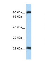 UHRF2 antibody Western blot of Mouse Pancreas lysate. Antibody concentration 1 ug/ml.
