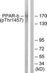 Western blot of extracts from HUVEC cells treated with Serum 20% 30', using PPAR-BP (Phospho-Thr1457) Antibody. The lane on the right was incubated with synthetic peptide.