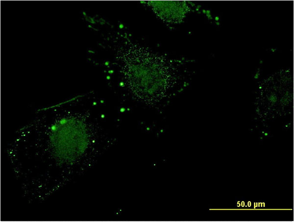 Immunofluorescence of monoclonal antibody to NIT1 on HeLa cell . [antibody concentration 10 ug/ml]