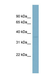 NIT1 antibody LS-C107914 Western blot of Fetal Small Intestine lysate.