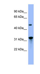 NIT1 antibody LS-C107704 Western blot of 293T cell lysate.