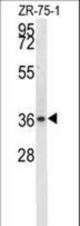 NIT1 Antibody western blot of ZR-75-1 cell line lysates (35 ug/lane). The NIT1 antibody detected the NIT1 protein (arrow).