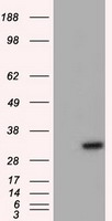 HEK293T cells were transfected with the pCMV6-ENTRY control (Left lane) or pCMV6-ENTRY NIT2 (Right lane) cDNA for 48 hrs and lysed. Equivalent amounts of cell lysates (5 ug per lane) were separated by SDS-PAGE and immunoblotted with anti-NIT2.