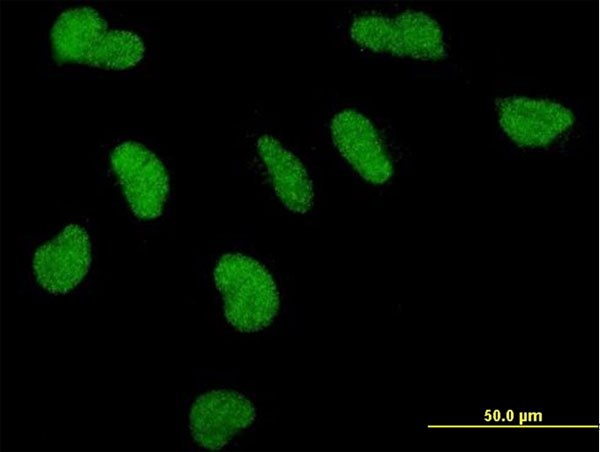 Immunofluorescence of monoclonal antibody to PPARBP on HeLa cell . [antibody concentration 10 ug/ml]