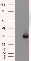 HEK293T cells were transfected with the pCMV6-ENTRY control (Left lane) or pCMV6-ENTRY NIT2 (Right lane) cDNA for 48 hrs and lysed. Equivalent amounts of cell lysates (5 ug per lane) were separated by SDS-PAGE and immunoblotted with anti-NIT2.