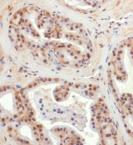 Immunohistochemistry: BNIP3L Antibody - Analysis of BNIP3L in mouse prostate using DAB with hematoxylin counterstain.