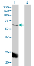 Western Blot analysis of PPARBP expression in transfected 293T cell line by PPARBP monoclonal antibody (M01), clone 2A2.Lane 1: PPARBP transfected lysate(61.6 KDa).Lane 2: Non-transfected lysate.