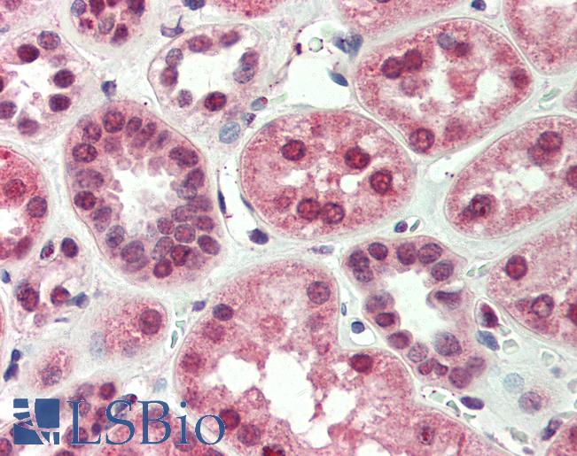 Anti-BNIP3L antibody IHC of human kidney. Immunohistochemistry of formalin-fixed, paraffin-embedded tissue after heat-induced antigen retrieval. Antibody LS-B459 concentration 5 ug/ml.