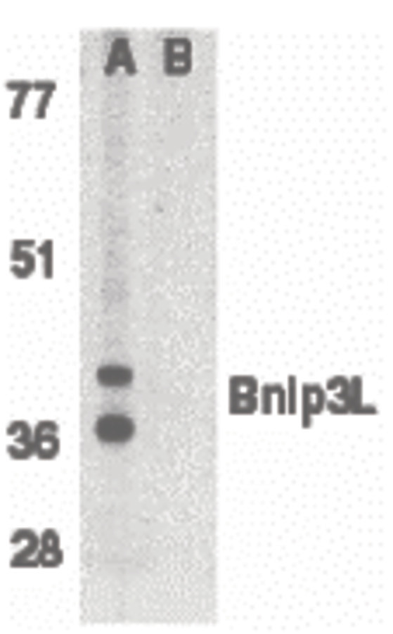 Western blot of Bnip3L in K562 whole cell lysate in the absence (A), or presence (B) of blocking peptide with Bnip3L antibody (IN) at 1 ug/ml.