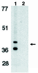 Western blot of anti-Bnip3L (IN) antibody at 1 ug/ml on K562 whole cell lysate in the absence (1) and presence (2) of immunogenic peptide.