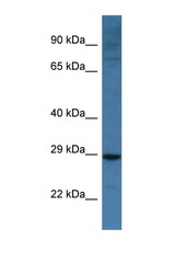 BNIP3L antibody LS-C145289 Western blot of Mouse Spleen lysate. Antibody concentration 1 ug/ml.