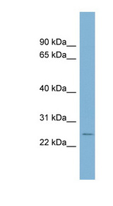 CD160 antibody LS-C110684 Western blot of THP-1 cell lysate.