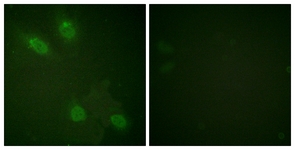 Immunofluorescence of HeLa cells, using PPAR-BP (Ab-1457) Antibody. The picture on the right is treated with the synthesized peptide.