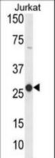 Western blot of CD160 Antibody in Jurkat cell line lysates (35 ug/lane). CD160 (arrow) was detected using the purified antibody.
