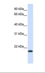 Fetal muscle lysate. Antibody concentration: 1.0 ug/ml. Gel concentration: 12%.