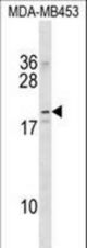 NKAIN2 Antibody western blot of MDA-MB453 cell line lysates (35 ug/lane). The NKAIN2 antibody detected the NKAIN2 protein (arrow).