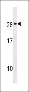 NKAI4 Antibody western blot of MCF-7 cell line lysates (35 ug/lane). The NKAI4 antibody detected the NKAI4 protein (arrow).