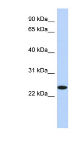 NKAIN4 antibody LS-C102521 Western blot of HepG2 cell lysate.