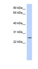 NKAIN4 antibody LS-C102522 Western blot of MCF7 cell lysate.