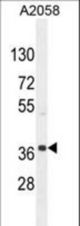 NKAPL Antibody western blot of A2058 cell line lysates (35 ug/lane). The NKAPL antibody detected the NKAPL protein (arrow).