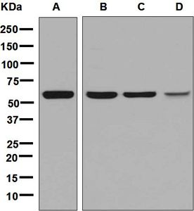 Western blot analysis on (A) HepG2, (B) SW480, (C) 293T, and (D) fetal kidney lysates using anti-NKD1 antibody.