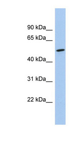 NKD1 antibody LS-C116192 Western blot of 721_B cell lysate.