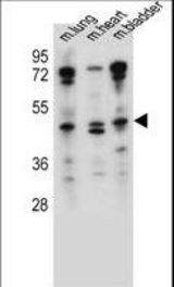 NKD1 Antibody western blot of mouse lung,heart,bladder tissue lysates (35 ug/lane). The NKD1 antibody detected the NKD1 protein (arrow).