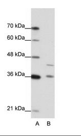 A: Marker, B: Jurkat Cell Lysate